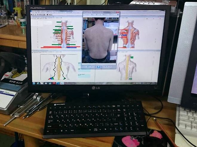 インサイトミレニアム